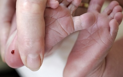 Sàng lọc sơ sinh phát hiện sớm bệnh nan y