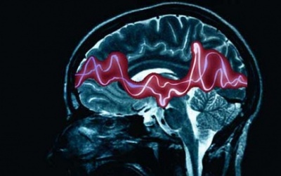 Lên cơn động kinh, bé trai 8 tuổi suýt chết trong hồ bơi