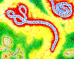 Quốc gia thứ 6 của Tây Phi có dịch Ebola