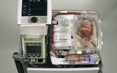 Tim ngừng đập 20 phút vẫn cấy ghép được