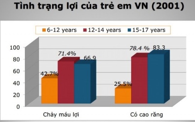 90% người Việt mắc bệnh nha chu
