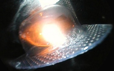 Khốn khổ vì uống thuốc quên bóc vỉ