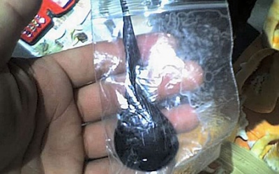 Nhập viện vì chữa bệnh bằng mật cá, mật động vật