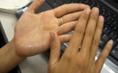 Tự ti giao tiếp vì bệnh tăng tiết mồ hôi