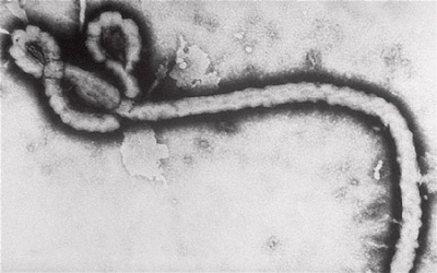 Ebola lây qua đường tình dục?