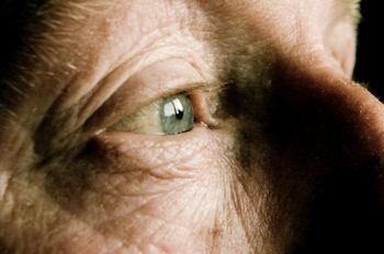 Thuốc điều trị HIV có thể chữa bệnh thoái hóa điểm vàng