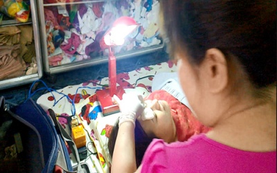 Rủi ro từ dịch vụ 'xăm dạo' 