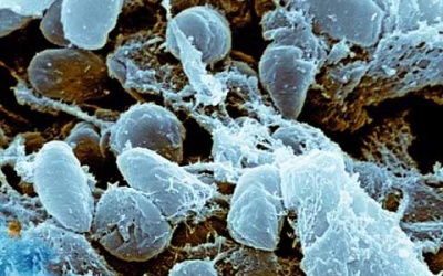 Cảnh giác dịch hạch