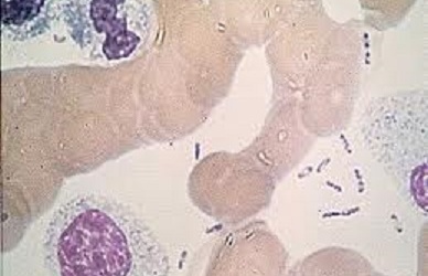 WHO cảnh báo nguy cơ tái bùng phát dịch hạch