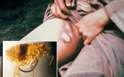 Cục Y tế Dự phòng khuyến cáo phòng chống dịch hạch