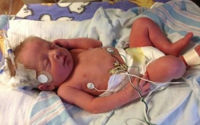 8 triệu trẻ sơ sinh tử vong mỗi năm