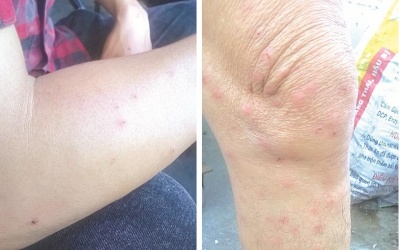 Côn trùng lạ tấn công người dân
