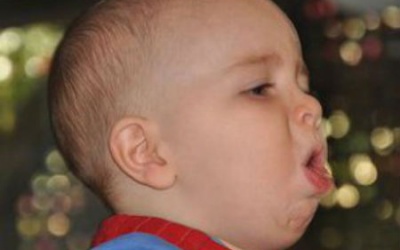 Trẻ bị ho: Những cách trị dứt điểm