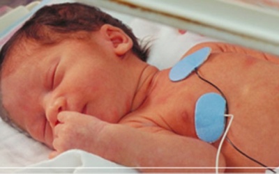 Các dị tật bẩm sinh thường gặp ở trẻ