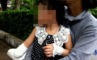 Cảnh báo hiểm họa từ máy xay thịt với trẻ em