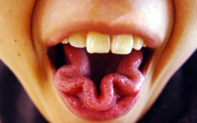 Lè cái lưỡi ra nào!