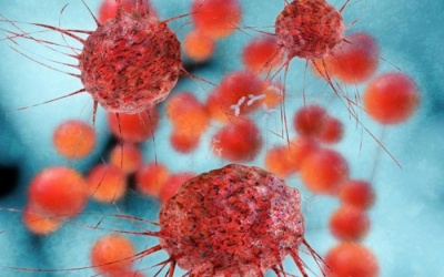 Dấu ấn sinh học của ung thư vú