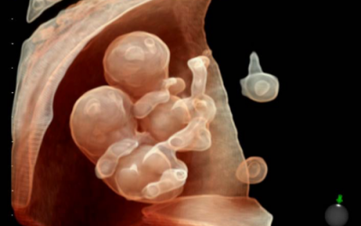 Những bức ảnh y học ấn tượng nhất năm 2014 (P2)