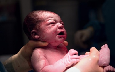 Kỳ diệu em bé chào đời từ người mẹ đã chết