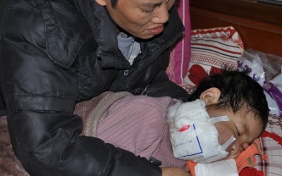 Xót thương hai bố con bị ung thư ôm nhau chờ chết