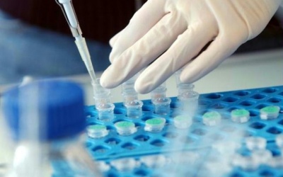 Cần biết khi xét nghiệm đái tháo đường