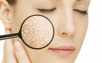 Cứu nguy “da rắn” mùa đông