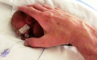 Hành trình giành giật sự sống của em bé nặng 600g