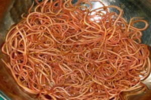 Bác sỹ kinh hãi gắp hơn 300 con giun trong bụng bệnh nhi 3 tuổi