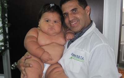 Bé gái 10 tháng tuổi nặng bằng trẻ lên 5