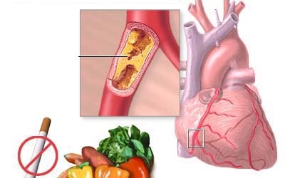 TPCN có phòng được bệnh tim mạch?