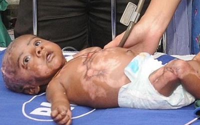 Lạ lùng đứa bé có khả năng tự thiêu