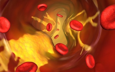 Tuổi trung niên nên 'biết lo' mỡ máu