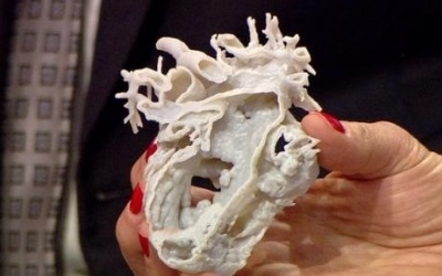 Bé gái 2 tuổi thoát chết nhờ trái tim được in 3D