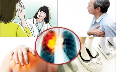 Nhận biết sớm ung thư phổi
