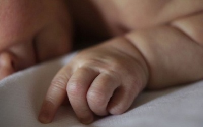 Kỳ lạ bé gái sơ sinh mang thai đôi