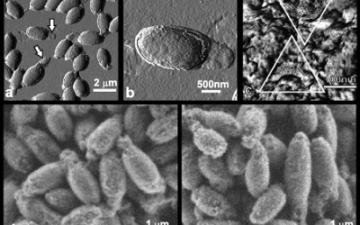 Khi vi khuẩn 'gặm'... khối u