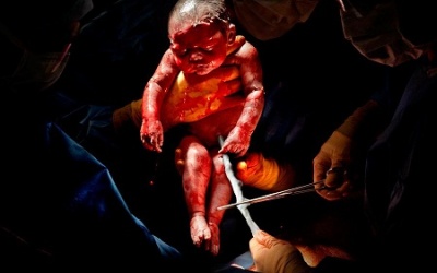 Photo: 20s cuộc sống đầu tiên của con người