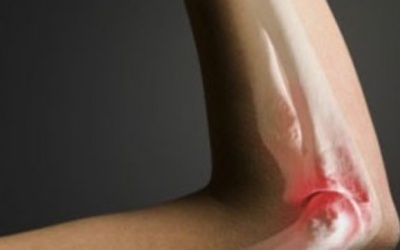 Ung thư xương có biểu hiện thế nào?