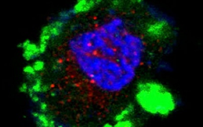 Lợi khuẩn probiotic hạn chế đái tháo đường