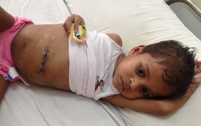 Cậu bé ăn tóc, bụng to như quả bóng