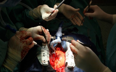 ​Không nên cấm người dưới 18 tuổi hiến mô, tạng?