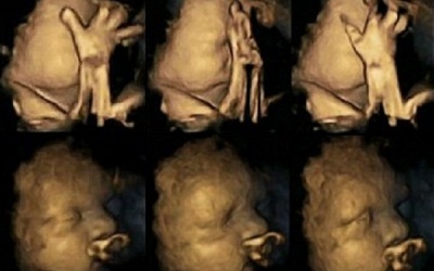 Các mẹ sẽ bỏ thuốc ngay sau khi xem ảnh này