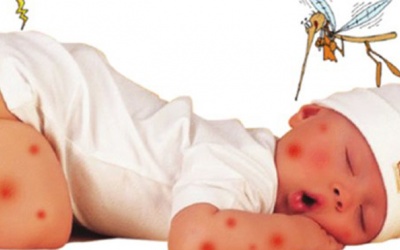 Lý do khiến bạn bị muỗi đốt nhiều hơn người khác?