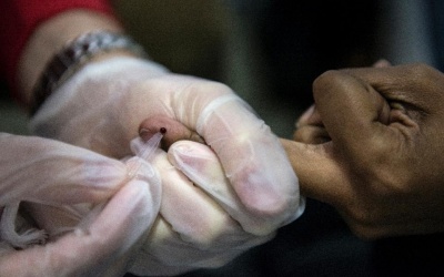 Tạo ra được kháng thể giúp giảm virus HIV trong máu