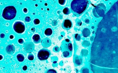 Mũi điện tử “ngửi” thấy nguy cơ ung thư dạ dày