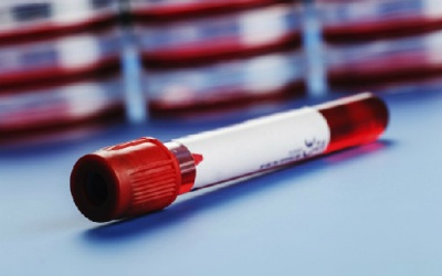 Xét nghiệm máu ra bệnh gì?