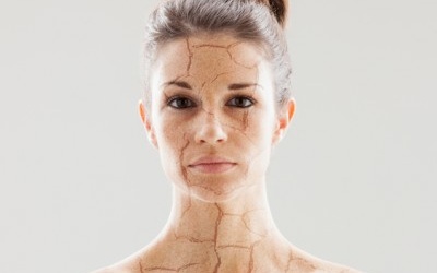 Infographic: Những lý do bất ngờ khiến da khô