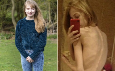 Thiếu nữ giảm cân để có thân hình giống thần tượng