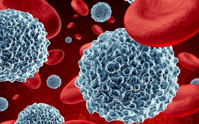 Tình cờ phát hiện “sát thủ” của bệnh ung thư