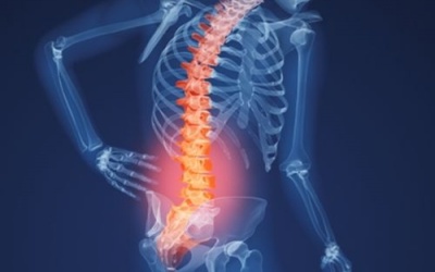 Đau lưng, mỏi cổ: Coi chừng tổn thương cột sống